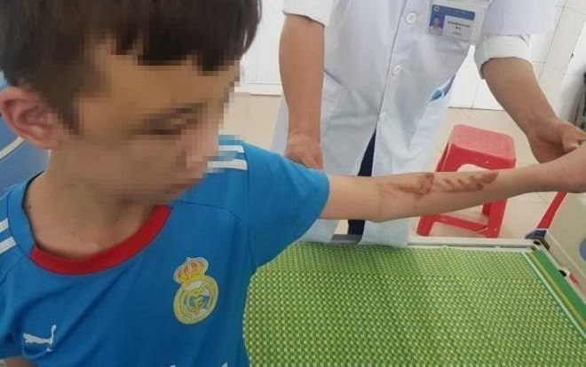 Luu Ban Nhap Tu Dong 253 1