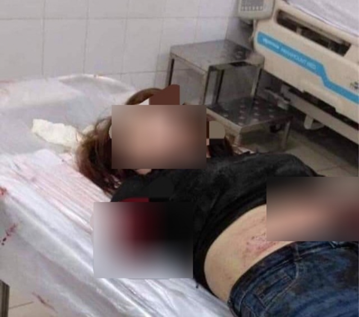 Tam Giu Hinh Su Nguoi Chong Chem Dut Lia 2 Canh Tay Vo O Dong Nai 2