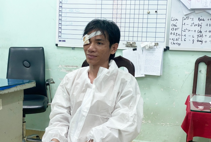 Loi Khai Cua Ke Cam Keo Xong Vao Tru So Tan Cong An Phuong O Quan Go Vap Tp Hcm 1