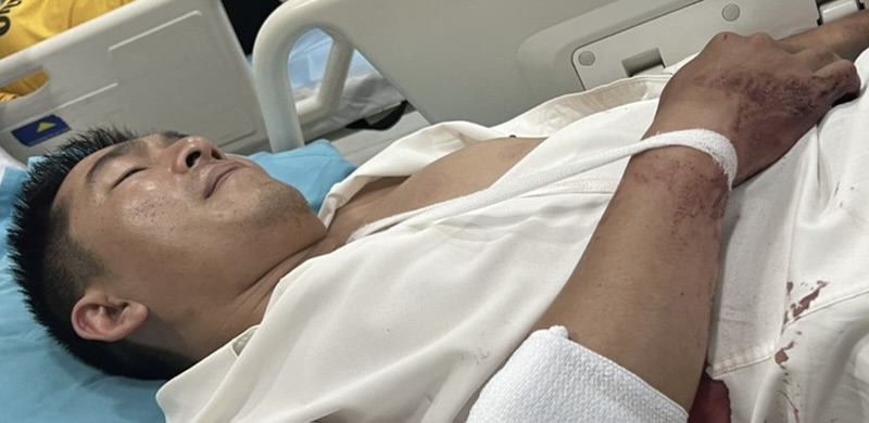 Mot Tham Phan O Lam Dong Bi Ke Trom Chem Bi Thuong 1