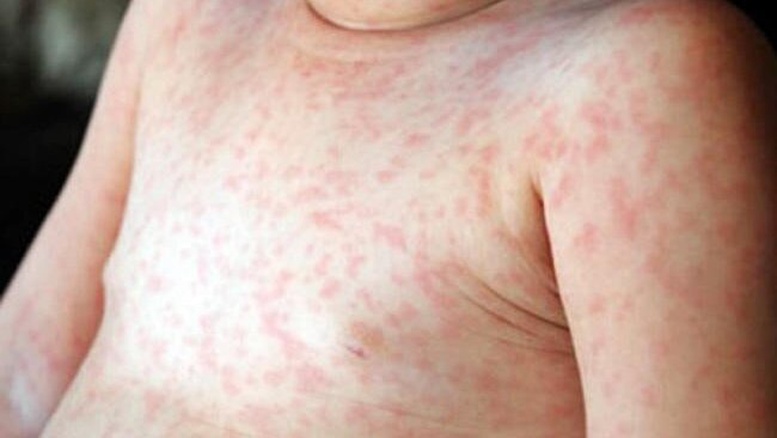 Luu Ban Nhap Tu Dong 2 1