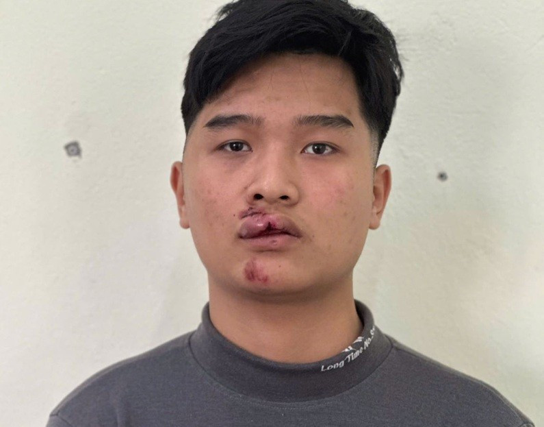 Khoi To Nam Thanh Nien Lai Xe May Dam Vao Csgt Hung Yen 1