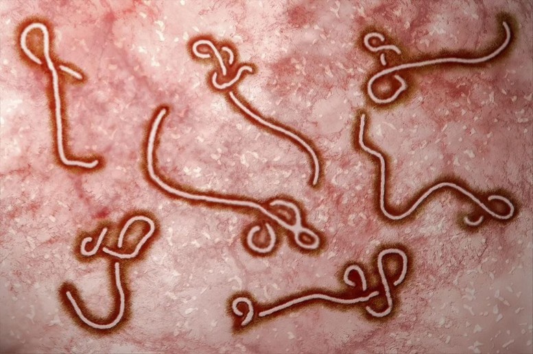 Who Bao Dong Khan Ve Ebola O Chau Phi Viet Nam Tang Giam Sat Cua Khau 1